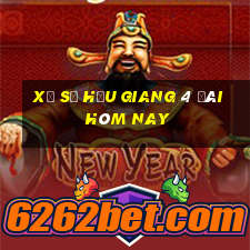 xổ số hậu giang 4 đài hôm nay