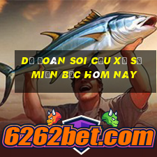 dự đoán soi cầu xổ số miền bắc hôm nay