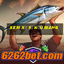 xem xổ số hậu giang