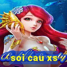 soi cau xs