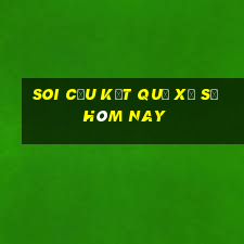 soi cầu kết quả xổ số hôm nay